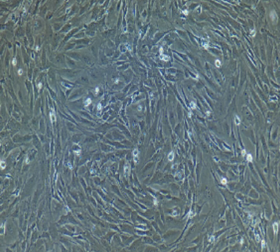 SDOW-17细胞