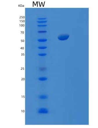 Recombinant E.coli SRS (Seryl-tRNA synthetase) Protein