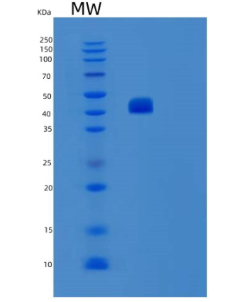 Recombinant Human ST6GAL1 Protein