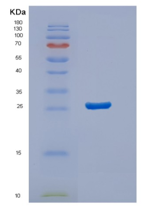 Recombinant Human STARD5 Protein