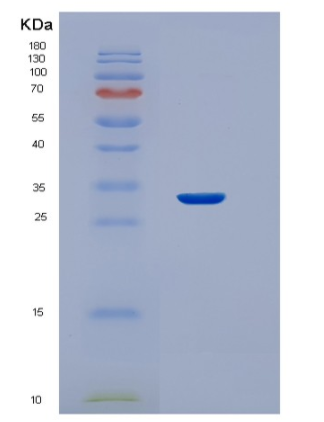 Recombinant Human STC2 Protein