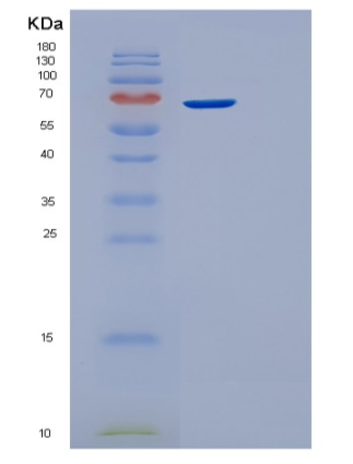 Recombinant Human STIP1 Protein