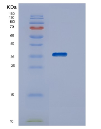 Recombinant Human STK16 Protein