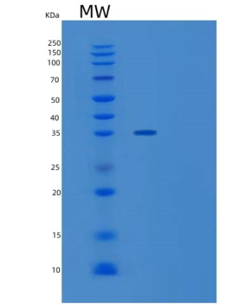 Recombinant Human SULT1A2 Protein