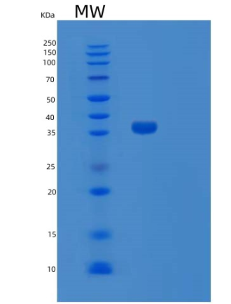 Recombinant Human SULT1C4 1-302aa Protein