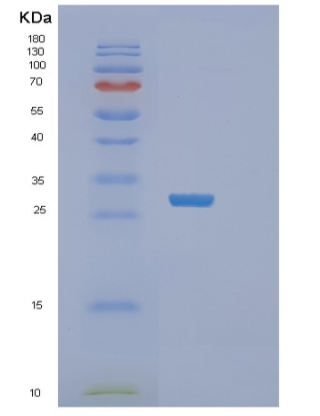 Recombinant Human TACO1 Protein