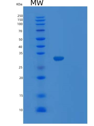 Recombinant Human TARDBP Protein