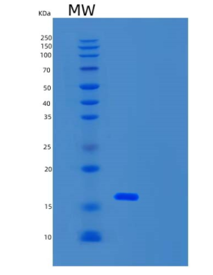 Recombinant Human TCL1B Protein