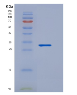 Recombinant Transcription Factor A, Mitochondrial (TFAM)