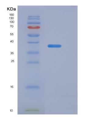 Recombinant Transforming Growth Factor Beta 3 (TGFb3)