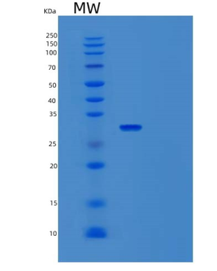 Recombinant Human TGIF2LX Protein