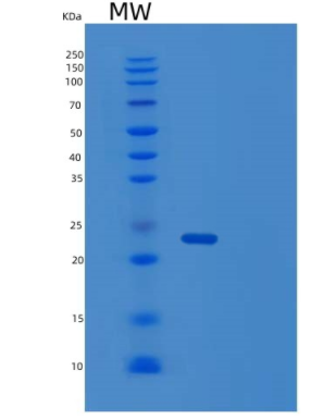 Recombinant Human TIMP1 Protein