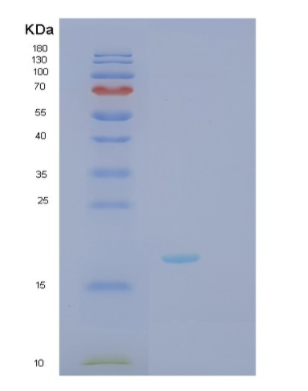 Recombinant Human TNF Protein