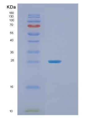 Recombinant Human TNFAIP8 Protein