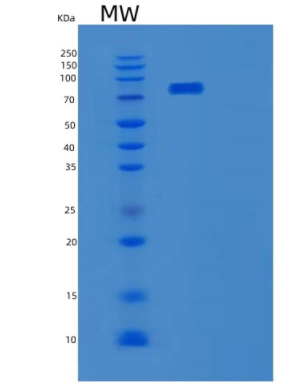 Recombinant Mouse Tgm2 Protein