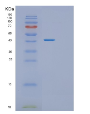 Recombinant Human TMOD3 Protein