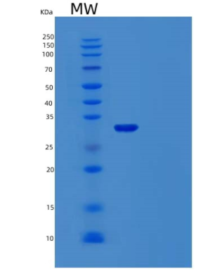 Recombinant Human TMEFF1 Protein