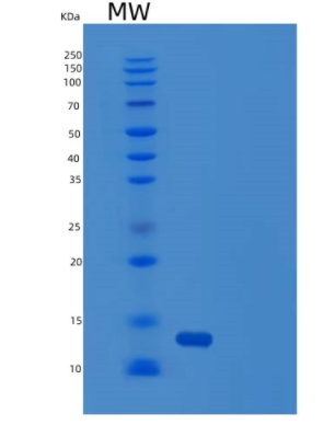 Recombinant Human TIMM8A Protein
