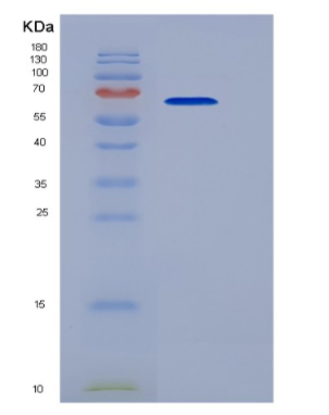 Recombinant Tumor Necrosis Factor Receptor Superfamily, Member 10C (TNFRSF10C)