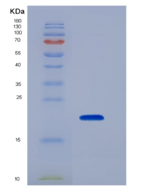 Recombinant Tumor Necrosis Factor Receptor Superfamily, Member 14 (TNFRSF14)