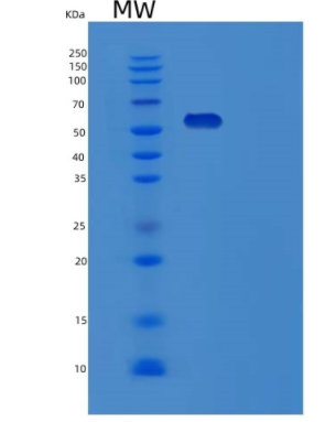Recombinant Human TOM1L2 Protein