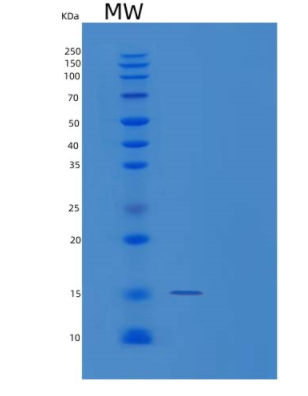 Recombinant Human TP53AIP1 Protein