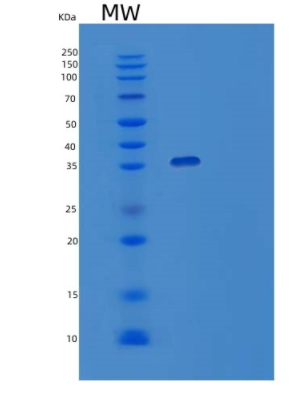 Recombinant Human TPM1 Protein