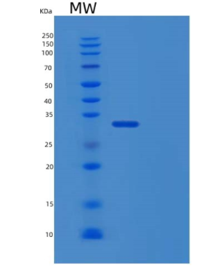 Recombinant Human TPM3 Protein