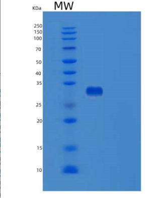 Recombinant Human TPSAB1 Protein