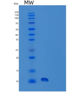 Recombinant Human TRIAP1 Protein