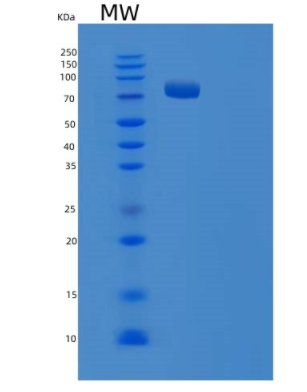 Recombinant E.coli TRS (Threonyl-tRNA synthetase) Protein