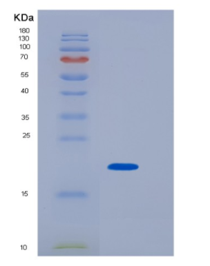 Recombinant Human TSG101 Protein