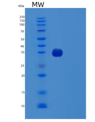 Recombinant Human TTC1 Protein