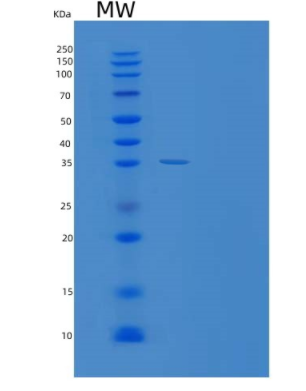 Recombinant Human TXNL1 Protein