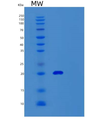 Recombinant Human UBE2A Protein