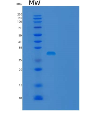 Recombinant Human UBE2Z Protein