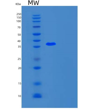 Recombinant Human UFD1L Protein
