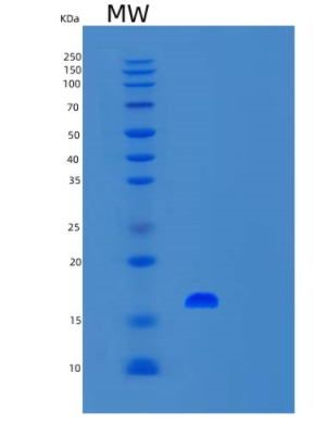 Recombinant Human UFSP1 Protein