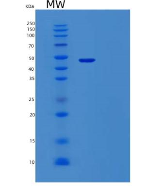 Recombinant Human Vaspin Protein