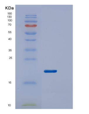 Recombinant Human VHL protein (β-domain : 1-154aa)