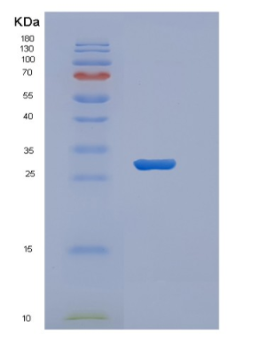 Recombinant Human VTCN1 Protein