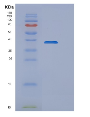 Recombinant Human WDR5 Protein