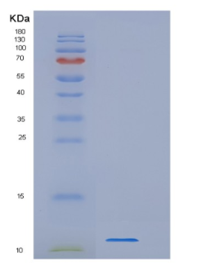 Recombinant Human WFDC12 Protein