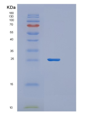Recombinant Human ZFAND5 Protein