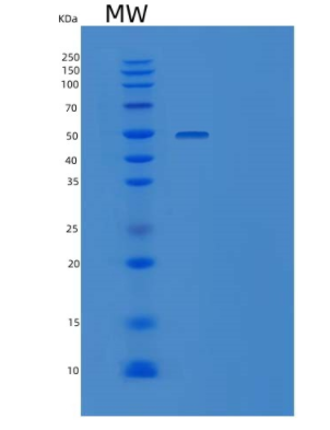 Recombinant Mouse Ephrin-B2/EFNB2 Protein(C-Fc-6His)