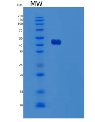 Recombinant Human Ubiquitin-Conjugating Enzyme E2 G2/UBE2G2/UBC7 Protein(N-GST)