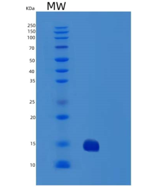 Recombinant Human TRAIL R2/TNFRSF10B/DR5/CD262 Protein(C-6His)