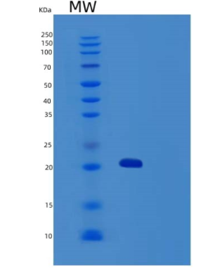 Recombinant Human TRAIL R3/TNFRSF10C/CD263 Protein(C-6His)