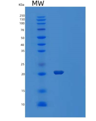 Recombinant Human Heat Shock Protein β-2//HSPB2/MKBP Protein(C-6His)