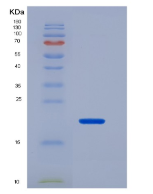 Recombinant Fibroblast Growth Factor 2, Basic (FGF2).